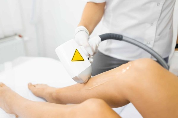 Epilation laser : sur quelle zone ? Le guide
